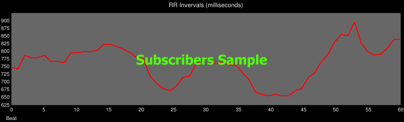 Heart RR Intervals Chart Sample
